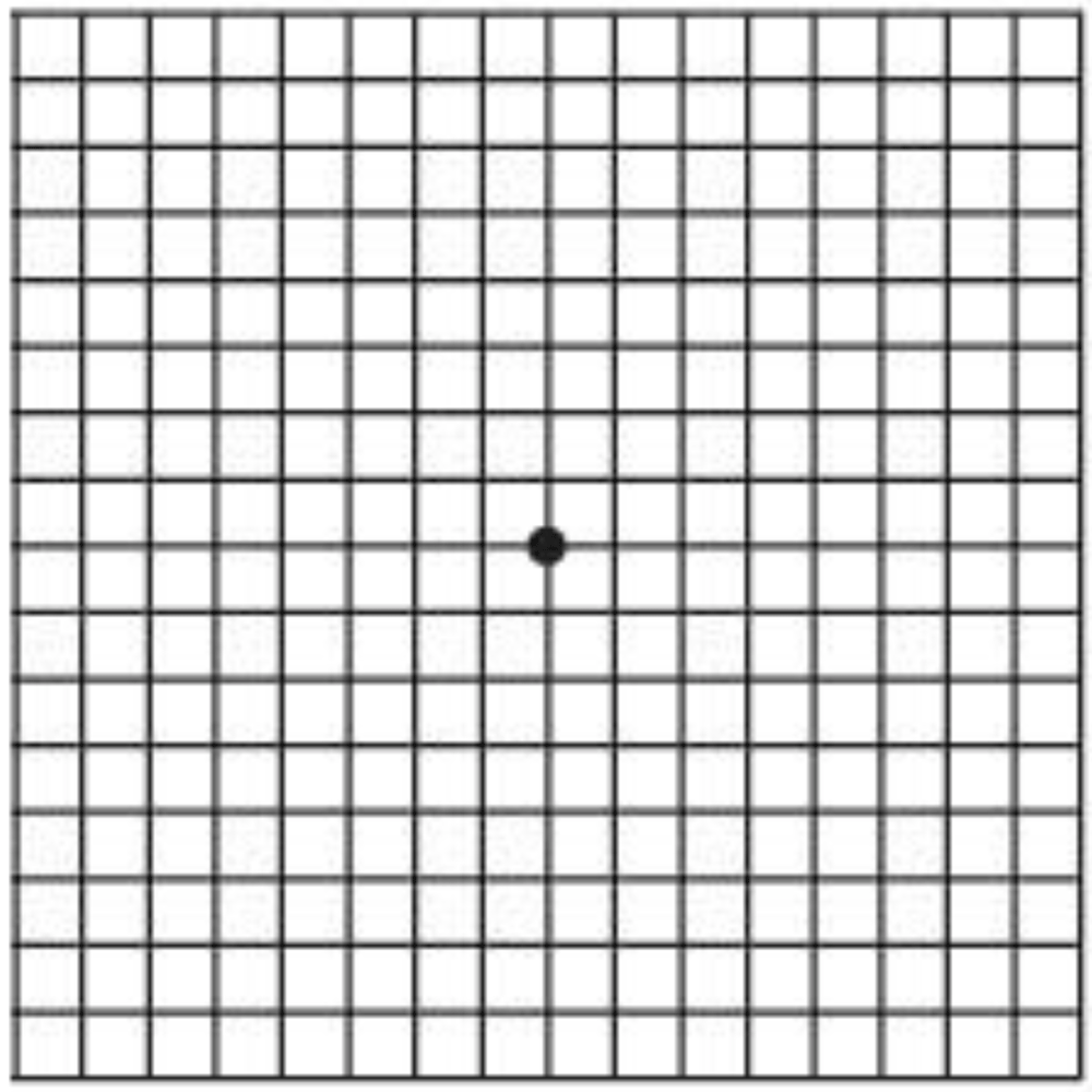 アムスラーチャート