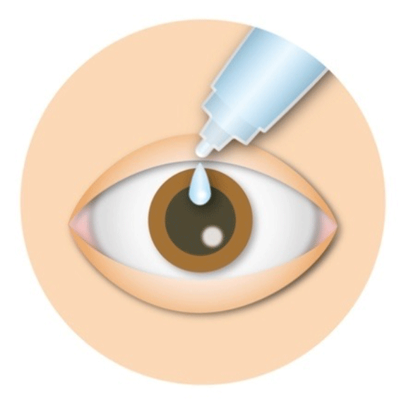 ルセンティス治療の手順①