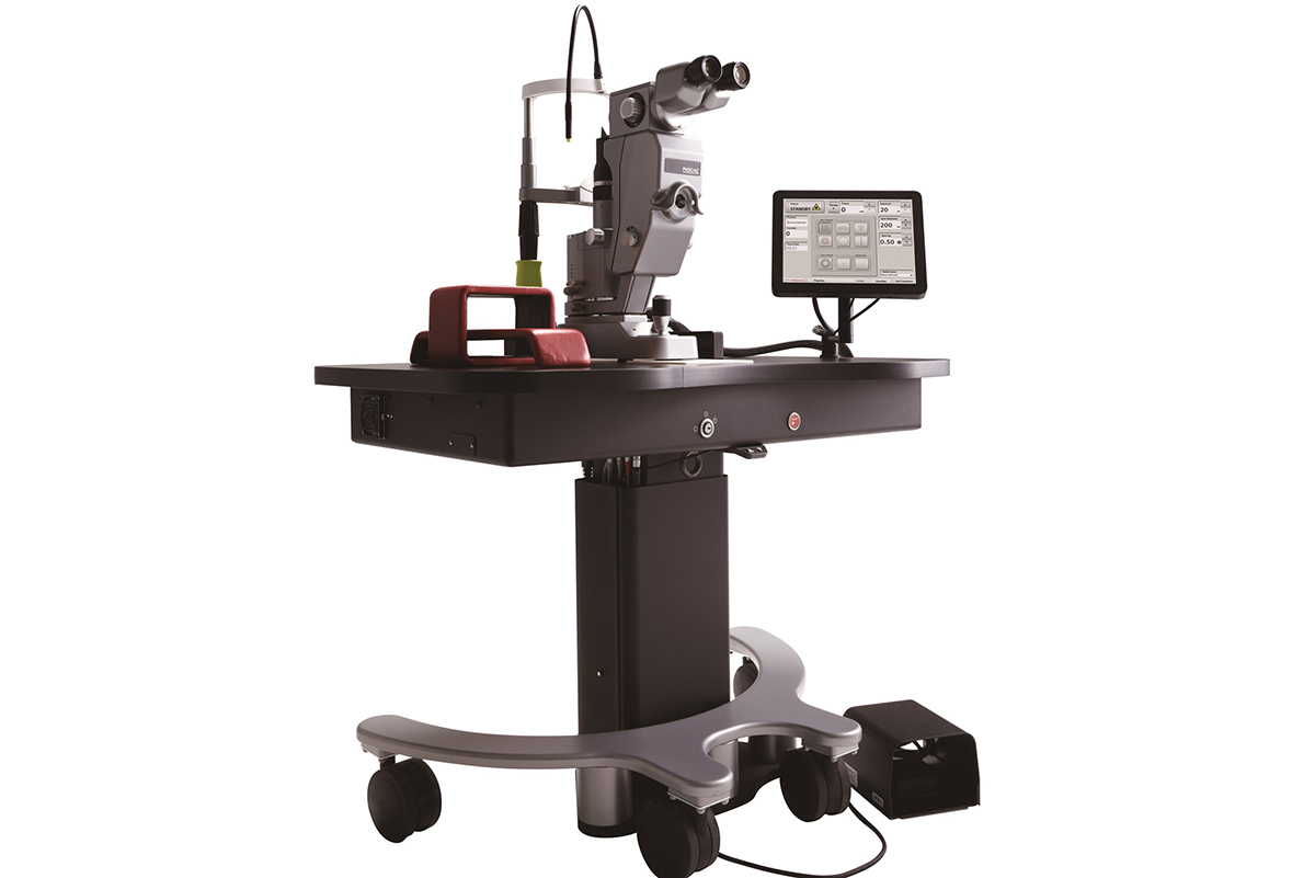 パターンスキャニングレーザー