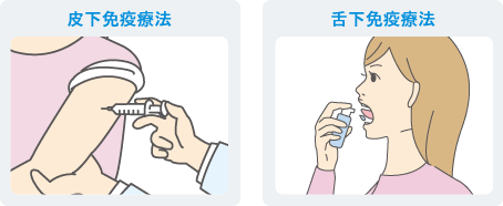 皮下免疫療法と舌下免疫療法