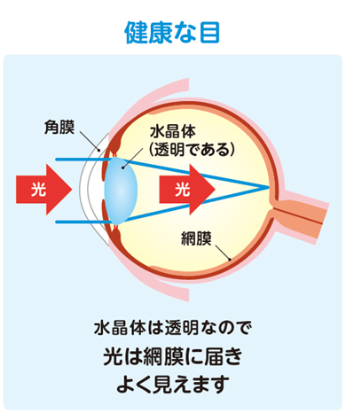 健康な目